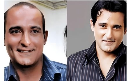 The Secret Behind Bollywood’s Perfect Hair Why Hair Patches Are Becoming the Go-To Solution